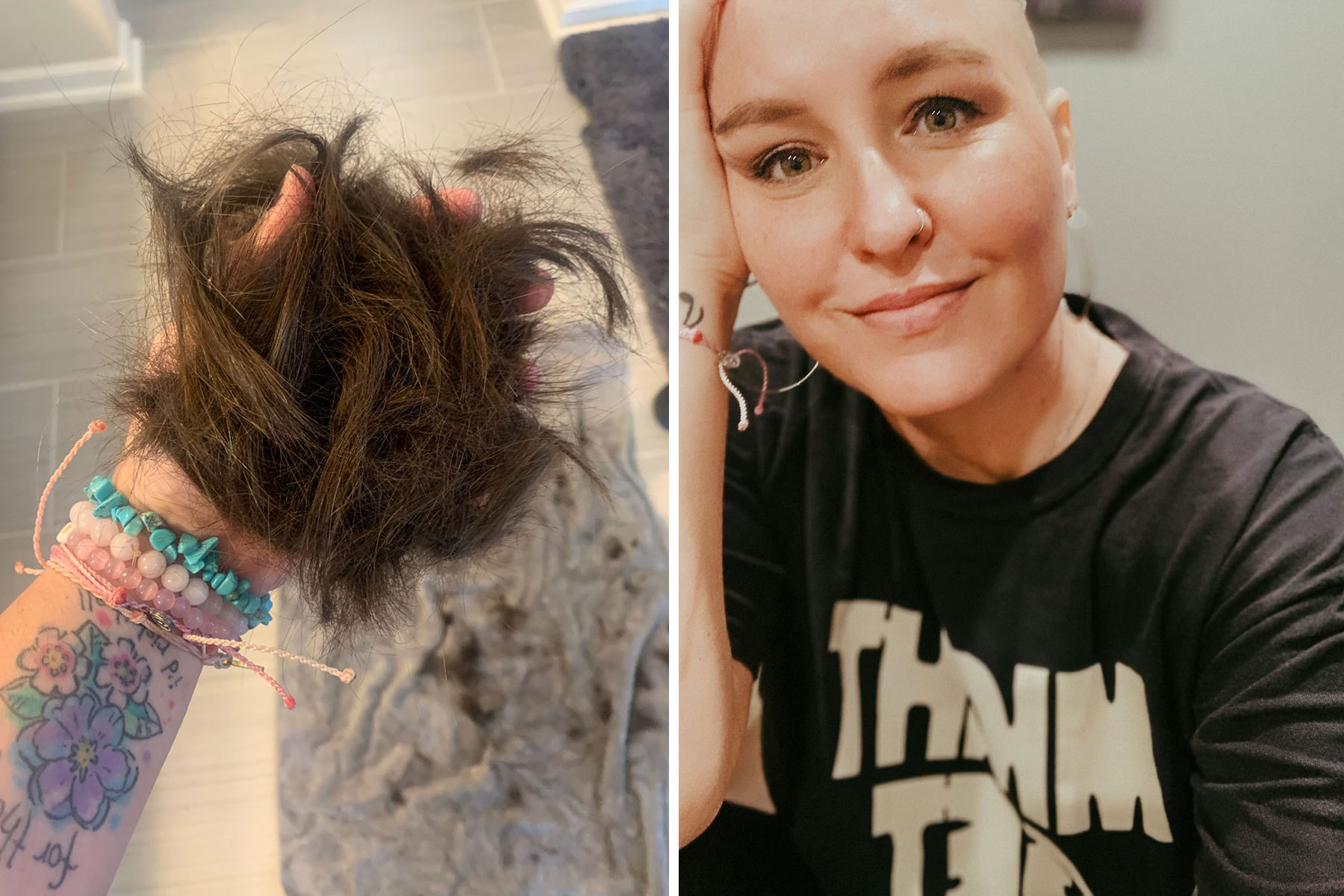 Mary holding hair in her hand, and a close-up of Mary after losing her hair to chemotherapy.